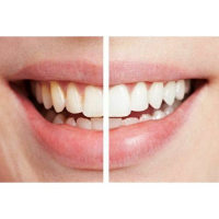 Spark Innovators Spin Smile 360 – Professional Grade Tooth Polisher & Whitener, White. Toothpaste TilyExpress 4