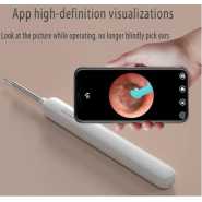 Visual Ear Wax Removal Tool With 1080P HD Waterproof Camera, Wireless Otoscope Double Quick Hand Pump,Suitable For IOS And Android Smartphones - Multicolor